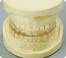 小児矯正の写真2