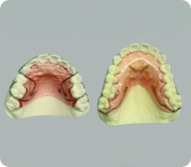 小児矯正の写真3
